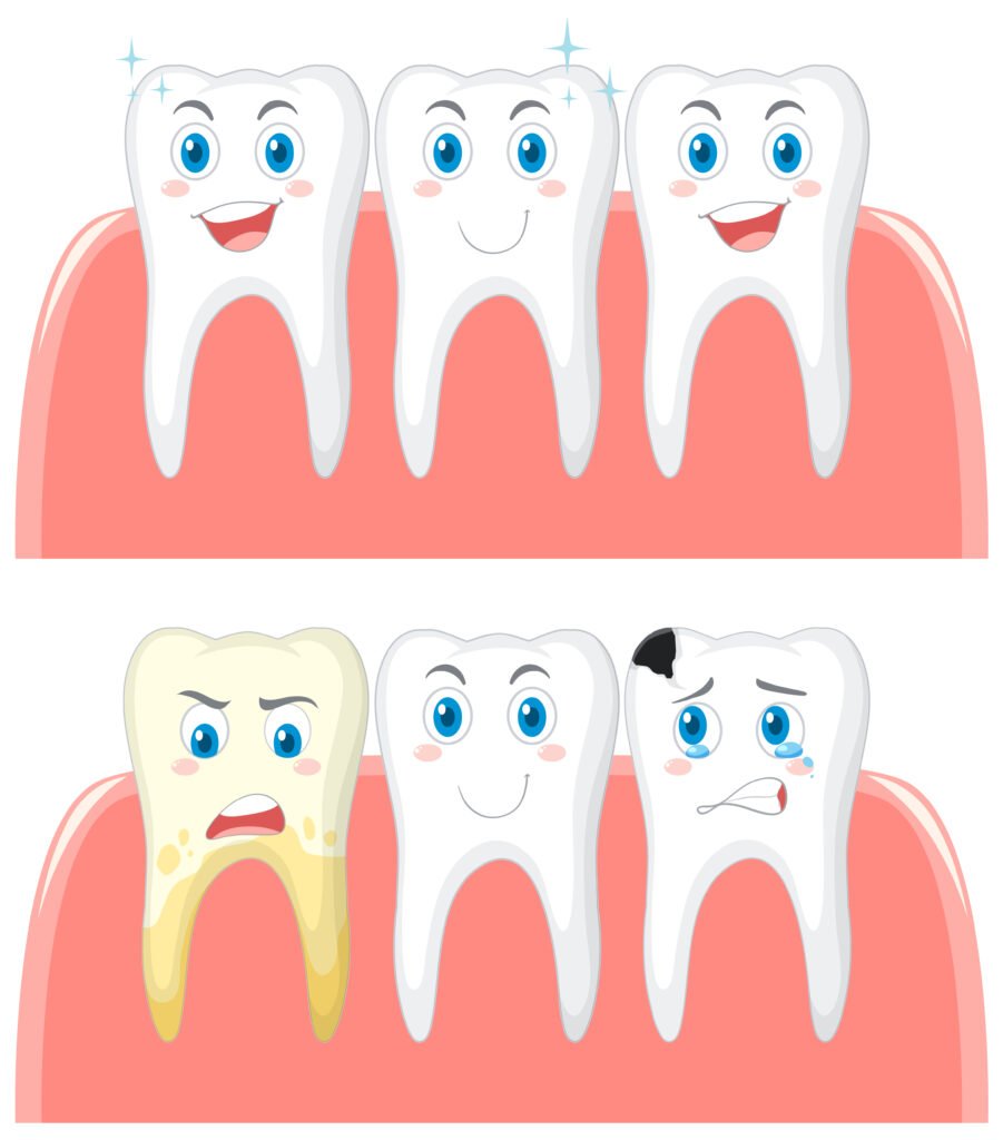 How to Prevent Dental Plaque