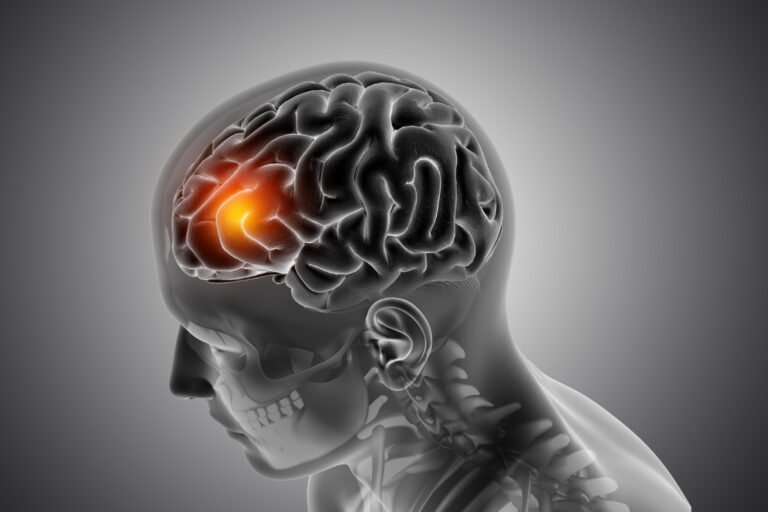 Metabolic Encephalopathy
