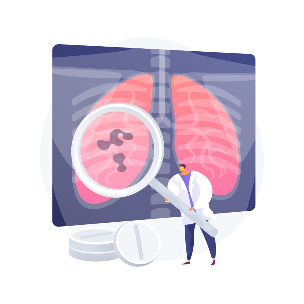 How is Walking Pneumonia Diagnosed?