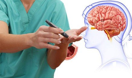 Diabetes and Stroke